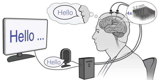Speech Decoding from Utah Arrays